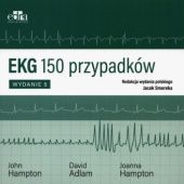 EKG. 150 przypadków