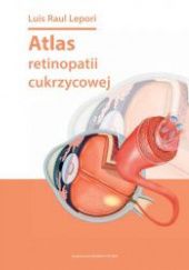 Okładka książki Atlas retinopatii cukrzycowej Luis Raul Lepori