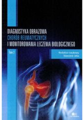 Okładka książki Diagnostyka obrazowa chorób reumatycznych i monitorowania leczenia biologicznego. Tom 2 Sławomir Jeka