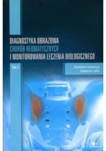 Okładki książek z cyklu Diagnostyka obrazowa chorób reumatycznych i monitorowania leczenia biologicznego