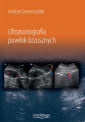 Okładka książki Ultrasonografia powłok brzusznych Andrzej Smereczyński