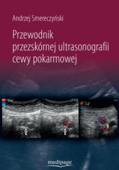 Okładka książki Przewodnik przezskórnej ultrasonografii cewy pokarmowej Andrzej Smereczyński