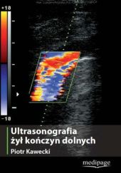 Okładka książki Ultrasonografia żył kończyn dolnych Piotr Kawecki