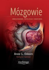 Okładka książki Mózgowie. Obrazowanie, patologia i anatomia Gary Hedlund, Anne G. Osborn, Karen L. Salzman