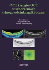 Okładka książki OCT i Angio-OCT w schorzeniach tylnego odcinka gałki ocznej Joanna Gołębiewska, Wojciech Hautz