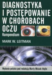 Okładka książki Diagnostyka i postępowanie w chorobach oczu. Kompendium Mark W. Leitman, Marta Misiuk-Hojło
