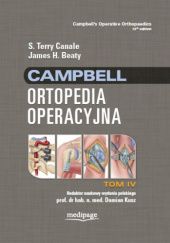 Okładka książki Campbell. Ortopedia operacyjna. Tom 4 James H. Beaty, S. Terry Canale, Damian Kusz