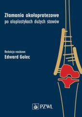 Okładka książki Złamania okołoprotezowe po aloplastykach dużych stawów Edward Golec