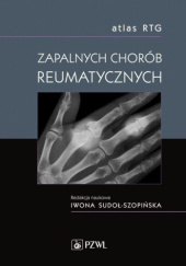 Okładka książki Atlas RTG zapalnych chorób reumatycznych Iwona Sudoł-Szopińska