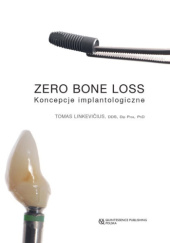 Okładka książki Zero bone Loss. Koncepcje implantologiczne Tomas Linkevičius