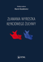 Okładka książki Złamania wyrostka kłykciowego żuchwy Marcin Kozakiewicz