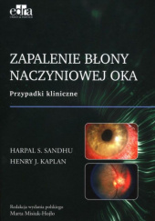 Okładka książki Zapalenie błony naczyniowej oka Henry J. Kaplan, Marta Misiuk-Hojło, Harpal S. Sandhu