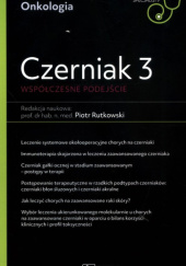 Okładka książki Czerniak 3. Współczesne podejście Piotr Rutkowski