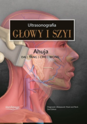 Okładka książki Ultrasonografia głowy i szyi Anil T. Ahuja