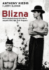 Okładka książki Blizna Wstrząsająca biografia lidera zespołu Red Hot Chili Peppers Anthony Kiedis,&nbsp;Larry Sloman